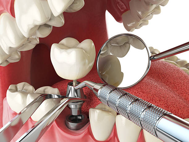 Best Dental Emergency Near Me  in South Kensington, MD